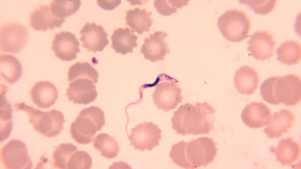 trypanosoma microscope slide